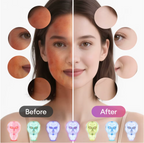 Photon Therapy Beauty Mask